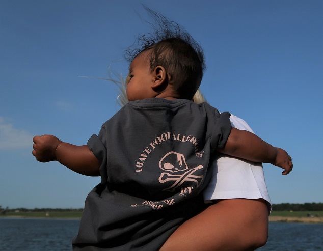 cute baby with allergy t-shirt
